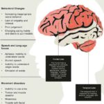 Frontal_Lobe_Dementia_Symptoms