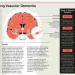 Understanding_Vascular_Dementia