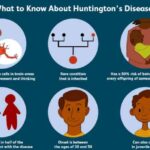 Huntingtons_Disease_infographic