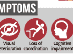 creutzfeldt jakob disease symptoms