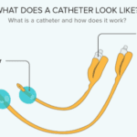 what does a foley catheter look like