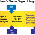 Parkinson's disease stages of progression