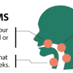 early symptoms of throat cancer infographic