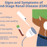 Signs And Symptoms Of End Stage Renal Disease ESRD