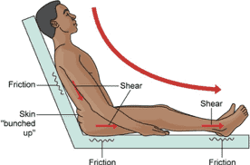 friction and shear pictorial