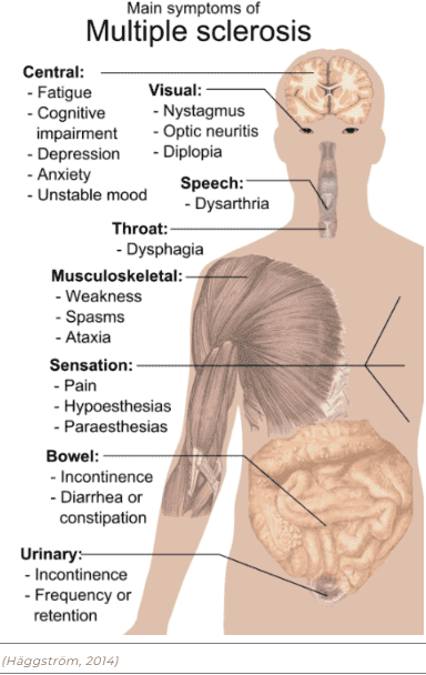 main symptoms of multiple sclerosis