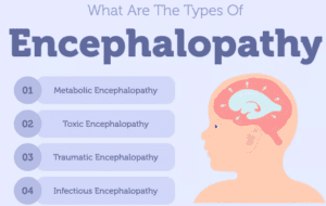 encephalopathy types