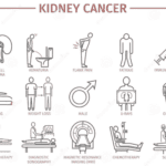 kidney cancer infographic