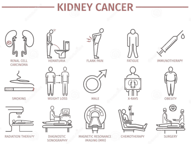 kidney cancer infographic