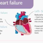 Types_of_Heart_Failure