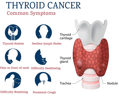 Understanding Thyroid Cancer: A Guide for Families