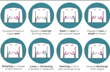 breast-cancer-symtpoms