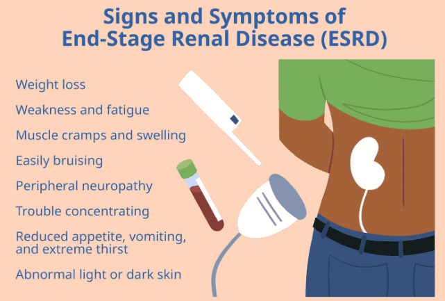 Signs And Symptoms Of End Stage Renal Disease ESRD