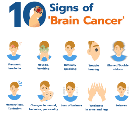 ten signs of brain cancer
