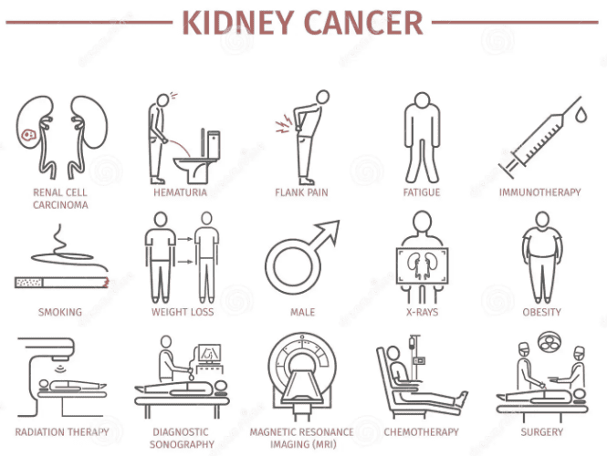 kidney cancer infographic