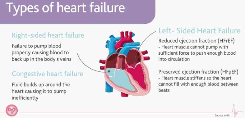 Understanding Heart Failure and What to Expect: A Guide for Families